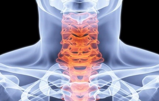 деформирующий спондилоартроз