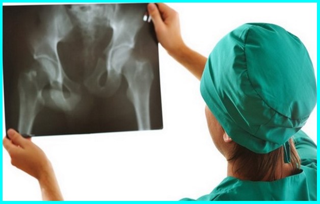 Физиотерапия при коксартрозе