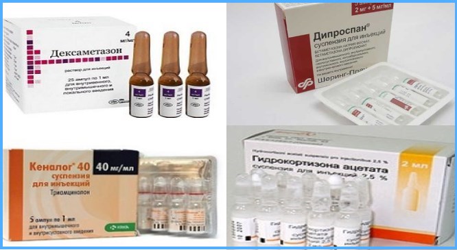 Гидрокортизон Дексамезатон Кеналог Дипроспан