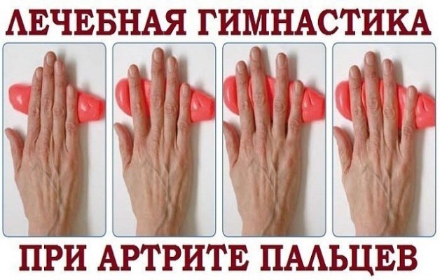 гимнастика при артрите
