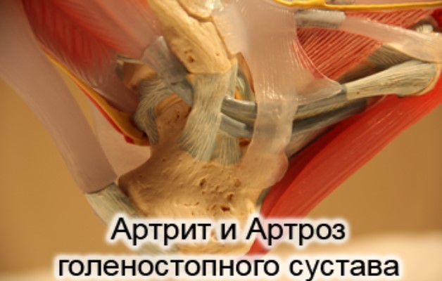 голеностопный сустав