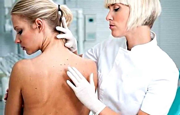 головные боли при шейном остеохондрозе