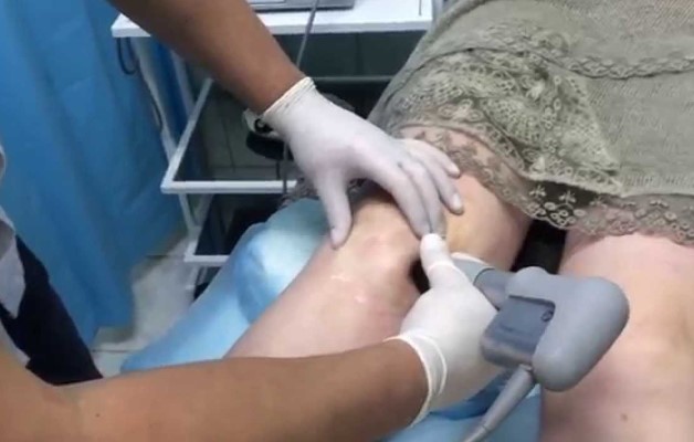 терапия гонартроза