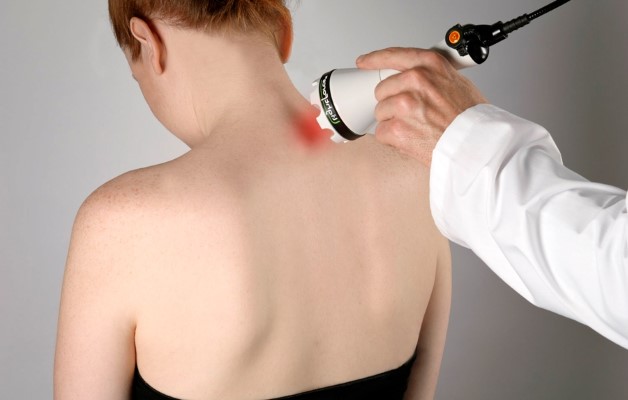 лазеротерапия