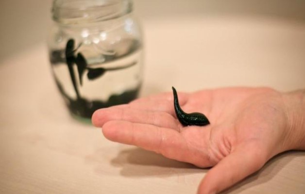 Лечение пиявками артрита рук