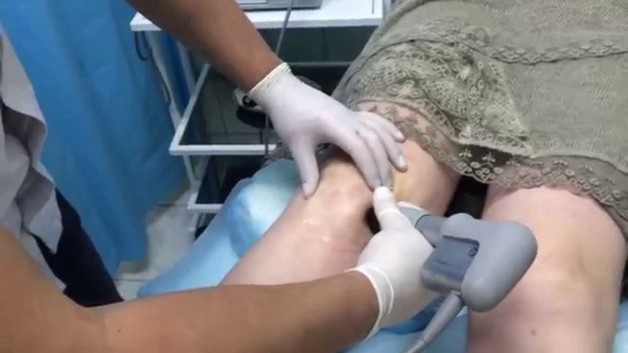 лечение ударно-волновой терапией