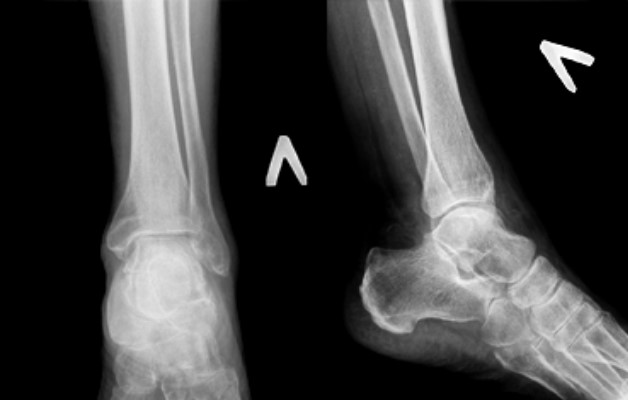 мрт снимок суставов