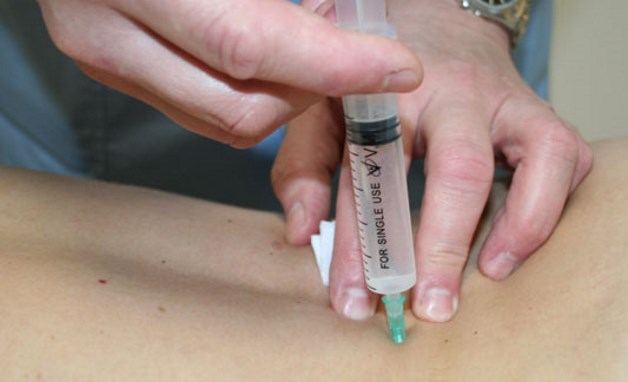 паравертебральная блокада