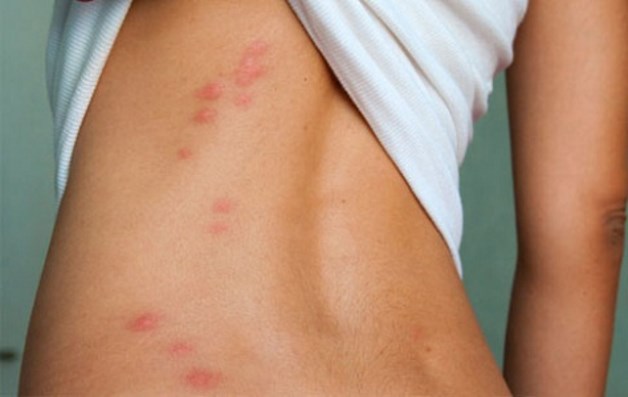 причины аллергии