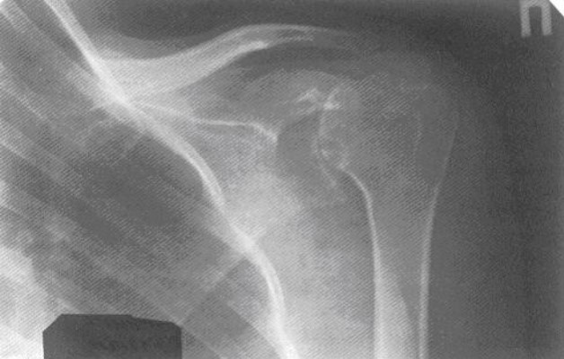 Рентгенологическая диагностика