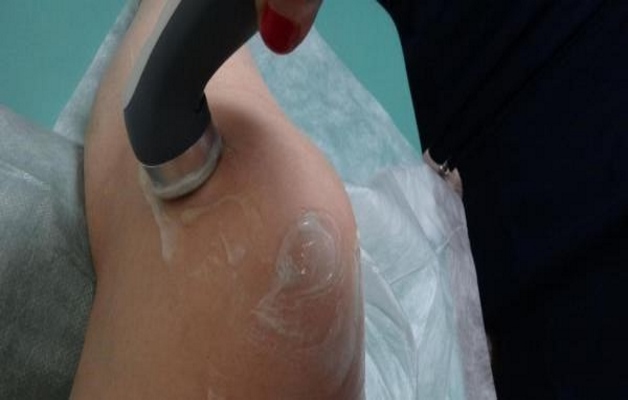 фонофорез с гидрокортизоном