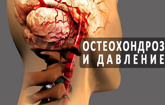 влияет ли остеохондроз на артериальное давление