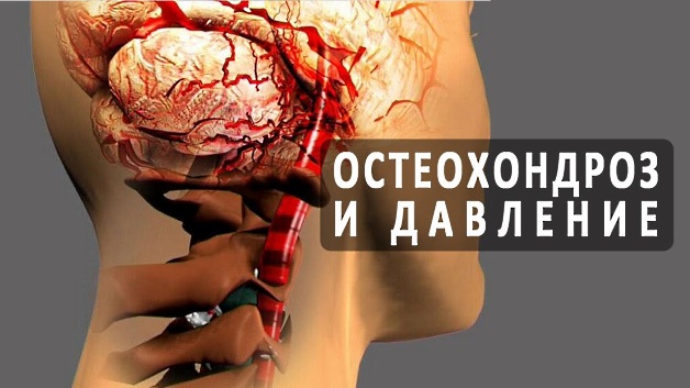 влияет ли остеохондроз на артериальное давление