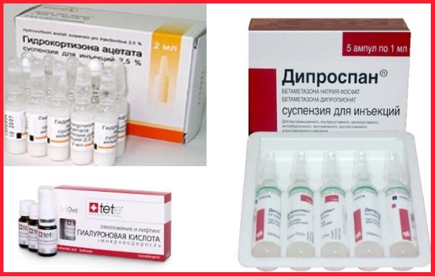 внутрисуставные уколы