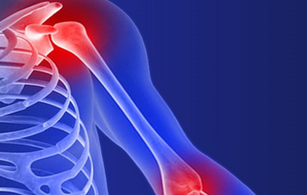 Артроз плечевого сустава