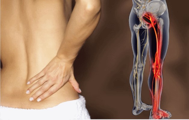 боль при коксартрозе