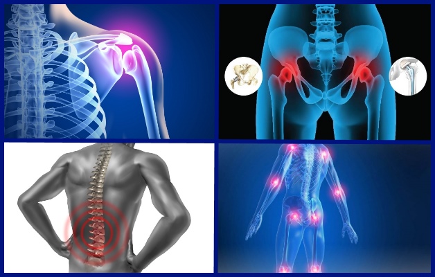 болезни суставов