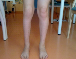 Больные суставы у маленьких детей