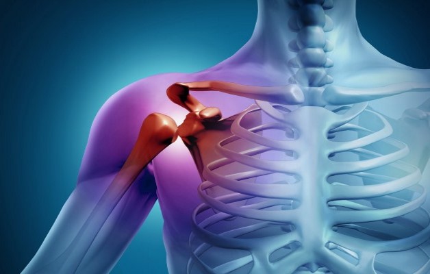 деформирующий артроз плечевого сустава