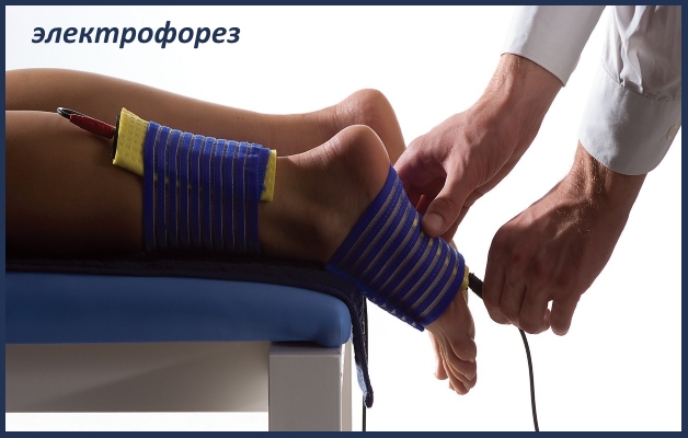 электрофорез при подагрическом артрите голеностопа