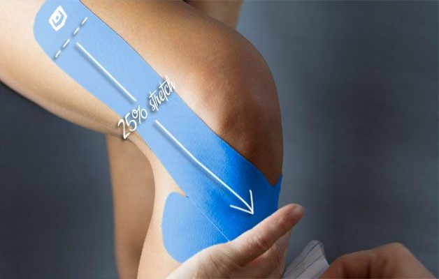 тейпирование колен