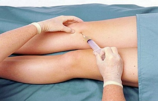 артроз коленного сустава