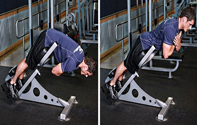 гиперэкстензия