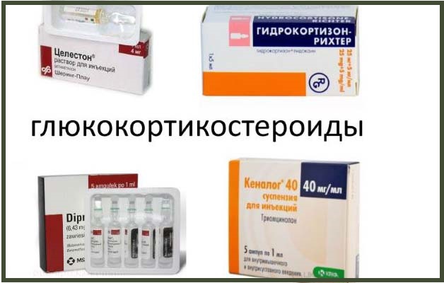 глюкокортикостероиды при плечевом артрозе