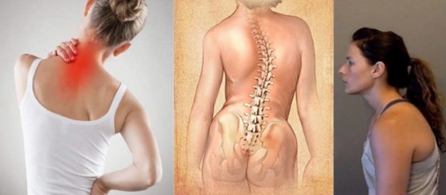 грыжа шморля сколиоз или остеохондроз