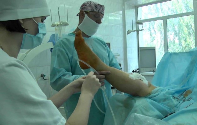 хирургическое вмешательство при гонартрозе