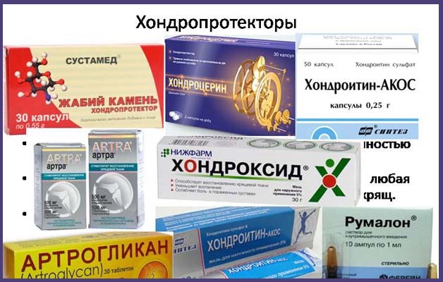 хондропротекторы при плечевом артрозе
