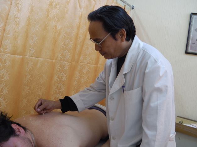 иглоукалывание