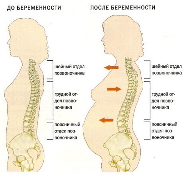 изменение позвоночника во время беременности