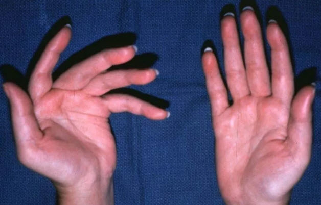 Ладони ярко-розового цвета.