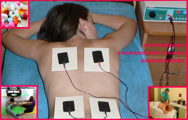 электрофорез в комплексном лечении остеохондроза