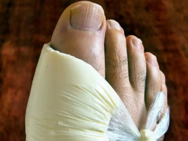 Компресс на ноге