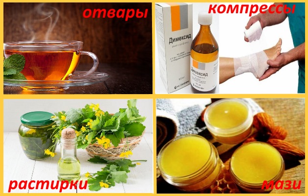 лечение артроза