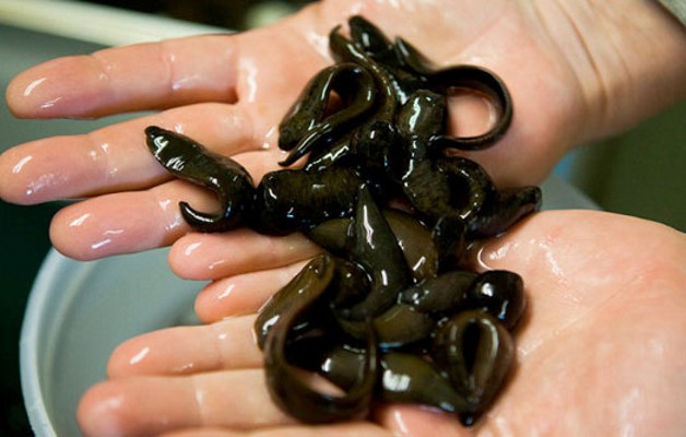 лечение пиявками