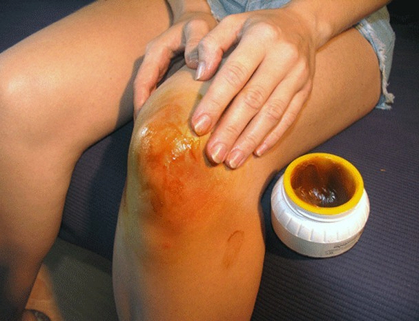 Втирание меда