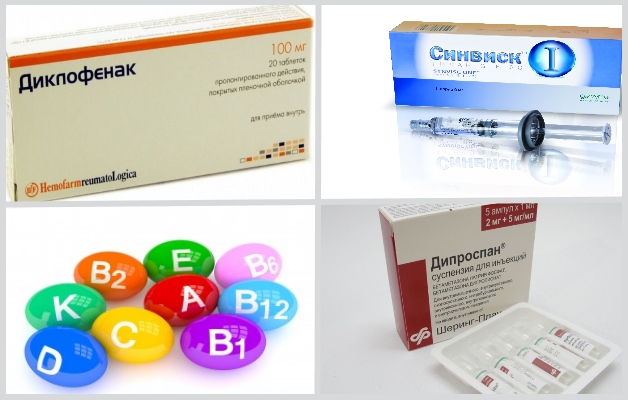 медикаментозная терапия при артрозе