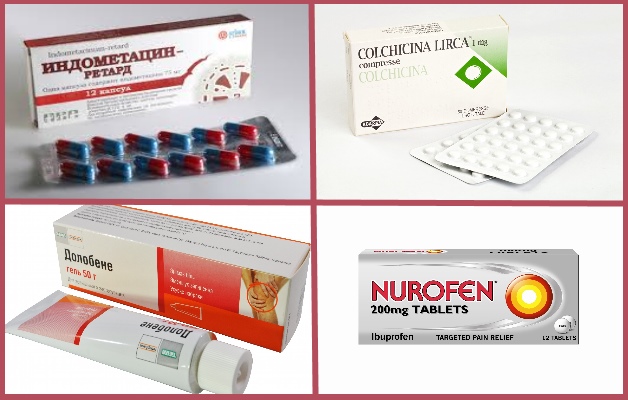 медикаментозное лечение подагры