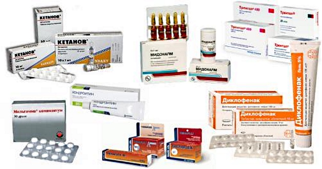 медикаментозная терапия шейного остеохондроза