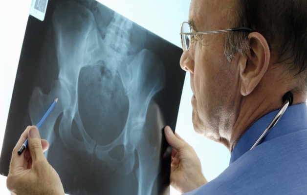 МРТ тазобедренного сустава