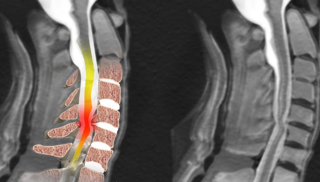 снимок с МРТ