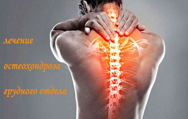 остеохондроз грудного отдела