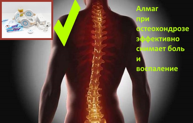 алмаг при остеохондрозе