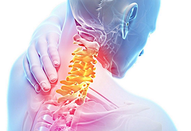 остеохондроз шейного отдела позвоночника