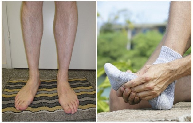 Плоскостопие с артрозом