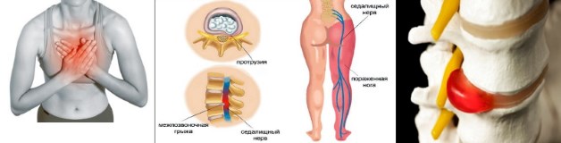 показания для приема