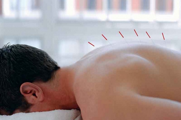 положение пациента во время иглоукалывания